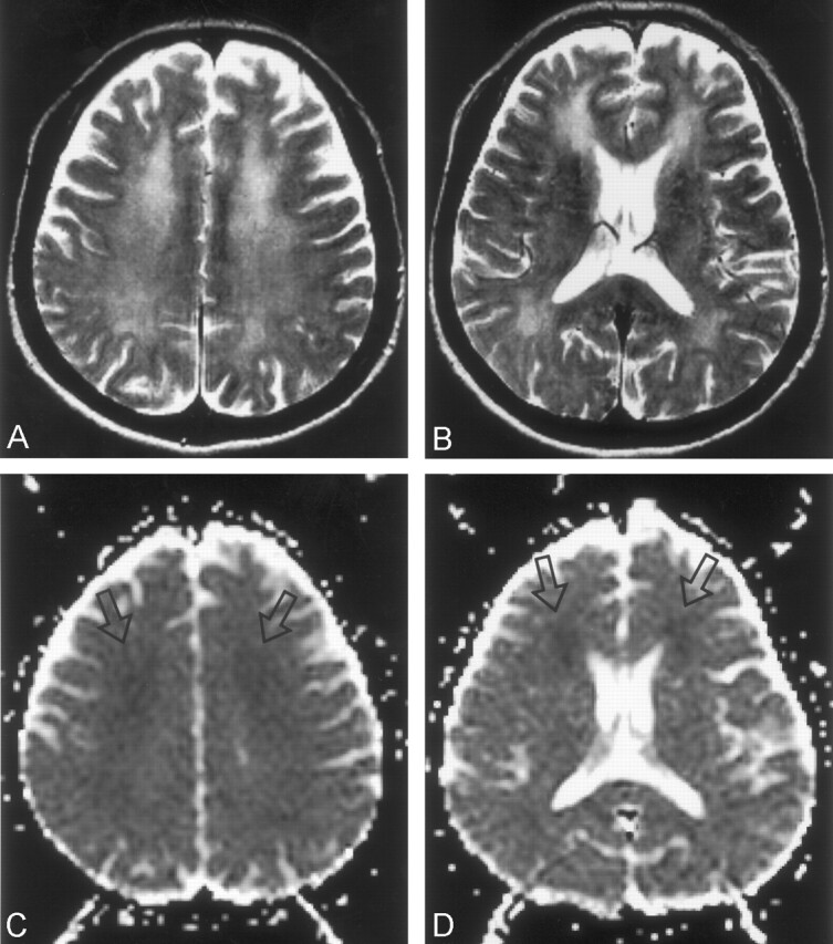 Fig 1.