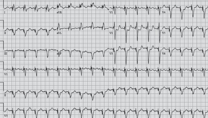 Figure 1)