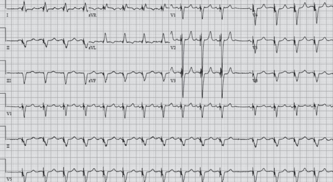 Figure 2)