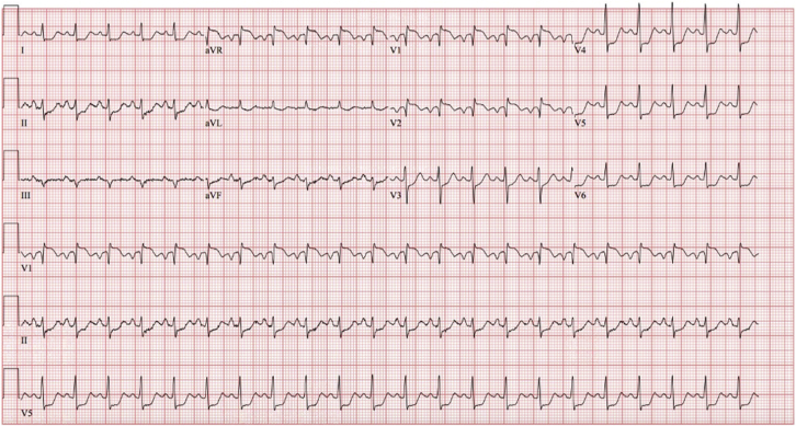 Figure 1