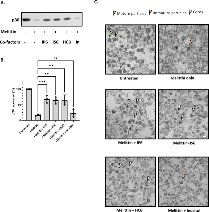 Three-panel figure analyzes p30 protein in pellets. Western blot shows p30 levels under different conditions, a bar graph plots p30 recovery with statistical significance indicated, and electron micrographs display untreated and treated samples.