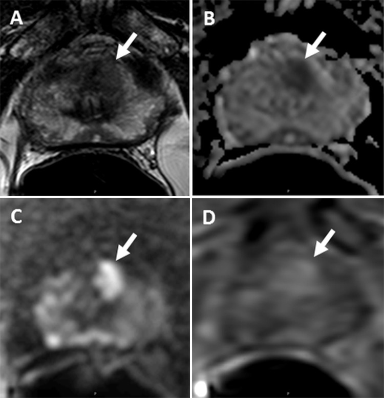 Figure 3: