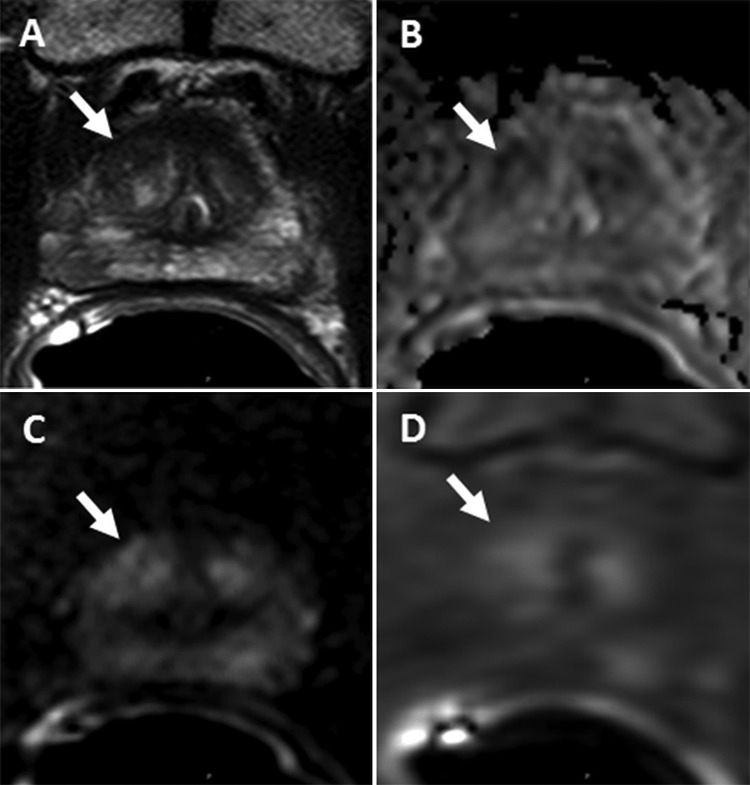 Figure 2: