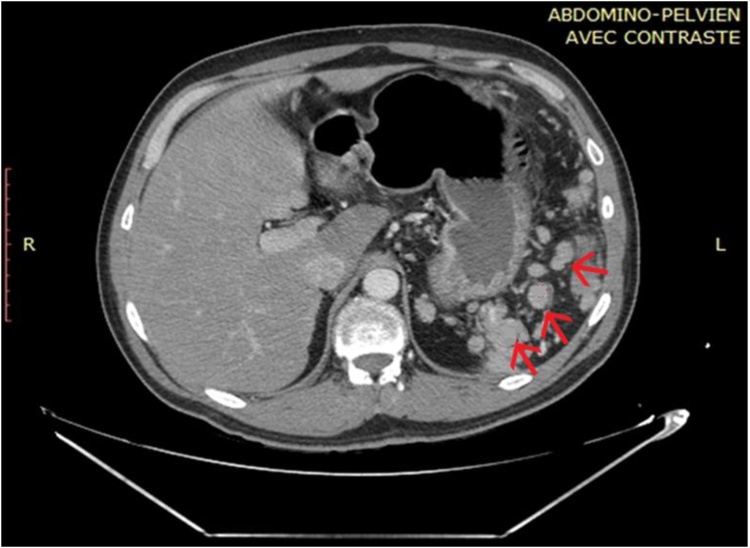 Fig. 1