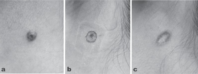 Fig. 5: