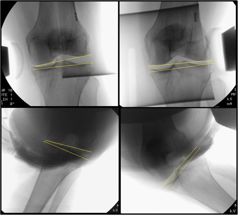 Fig. 2