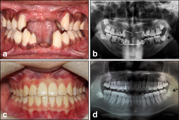 Fig. 1