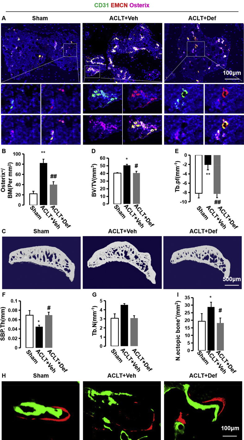 Defactinib attenuates osteoarthritis by inhibiting positive feedback ...