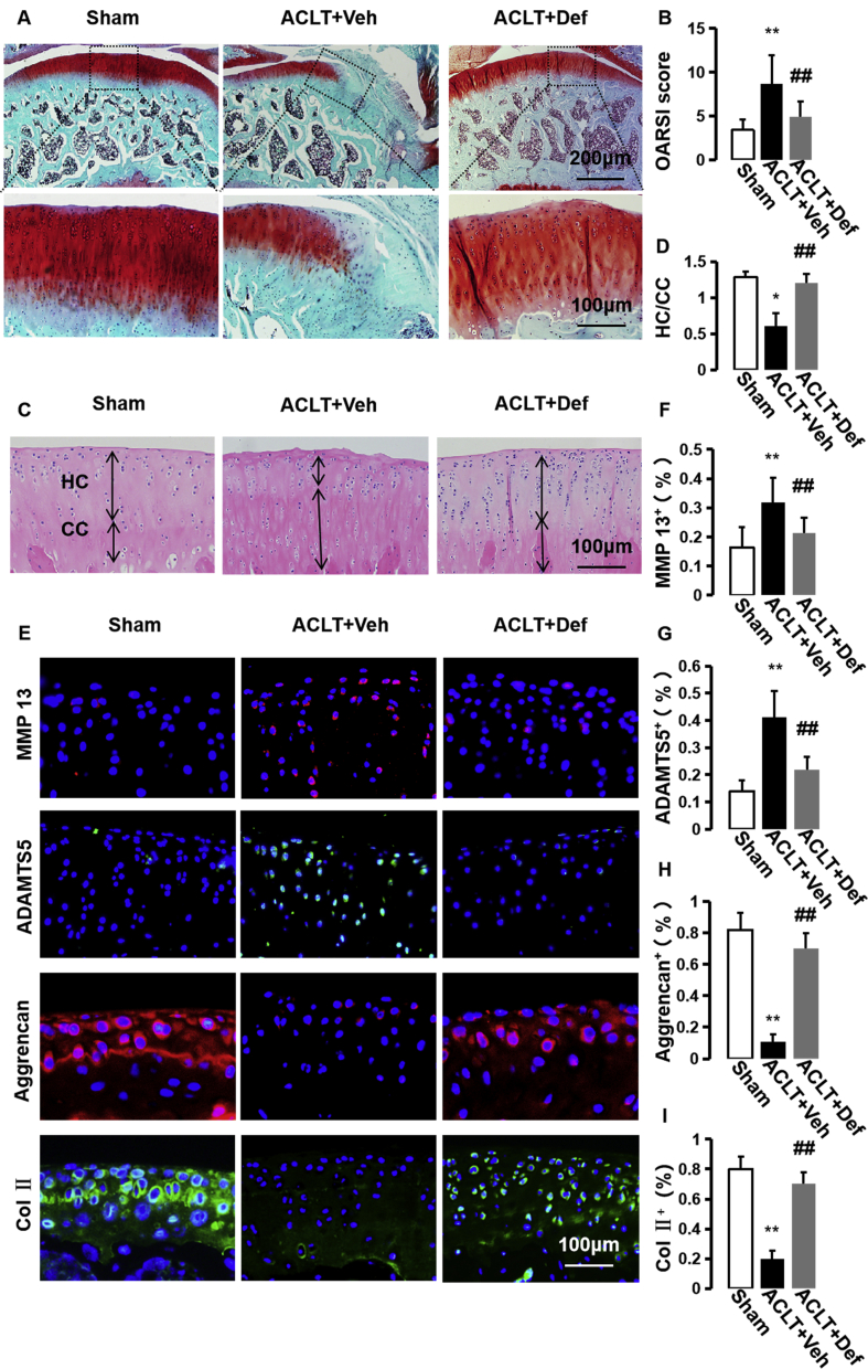 Defactinib attenuates osteoarthritis by inhibiting positive feedback ...