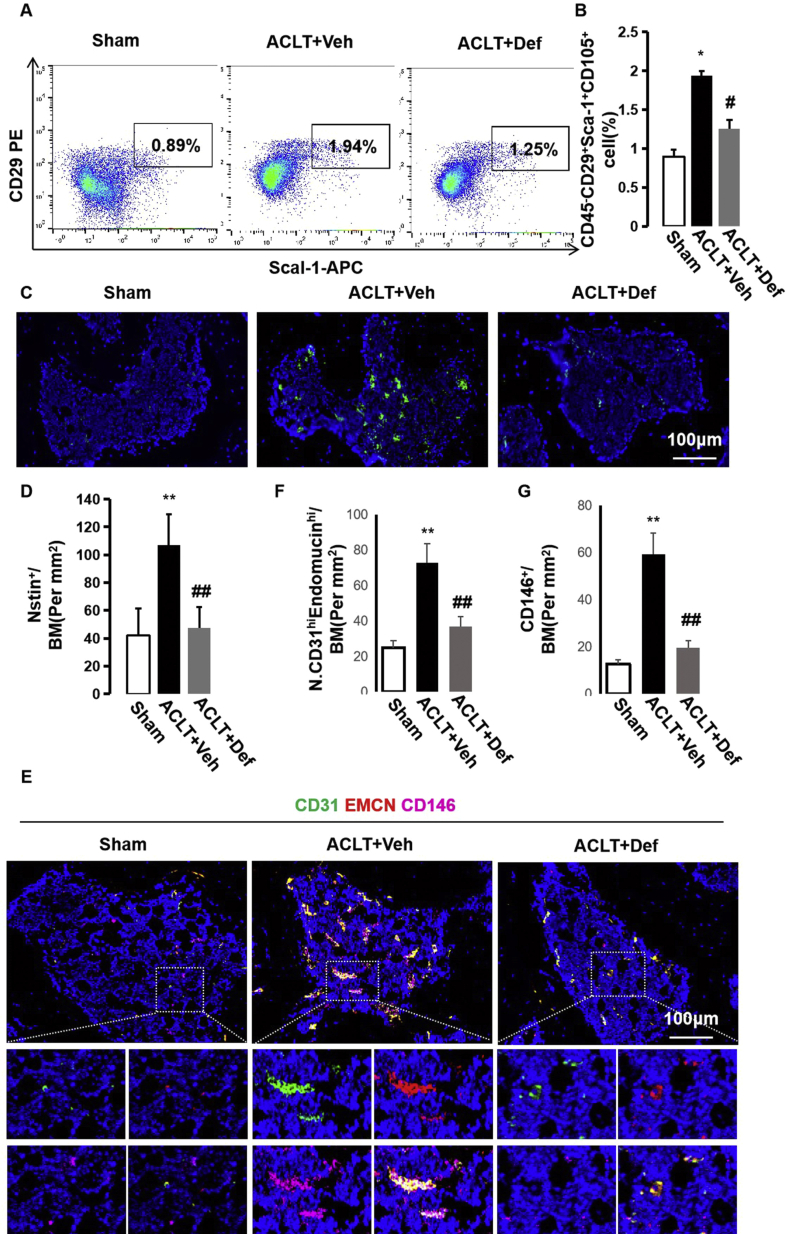 Defactinib attenuates osteoarthritis by inhibiting positive feedback ...