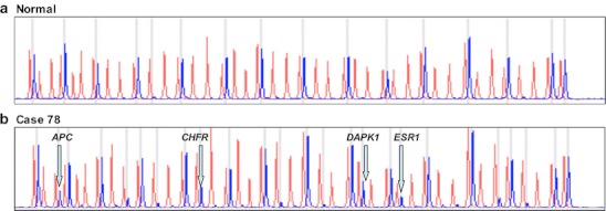 Fig. 1