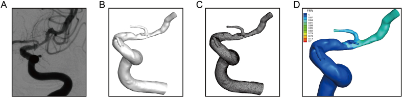 Fig. 1