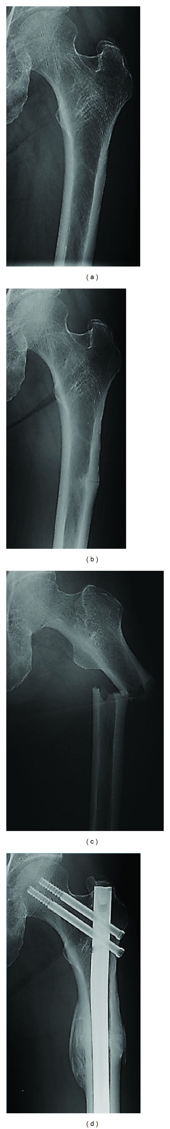 Figure 2