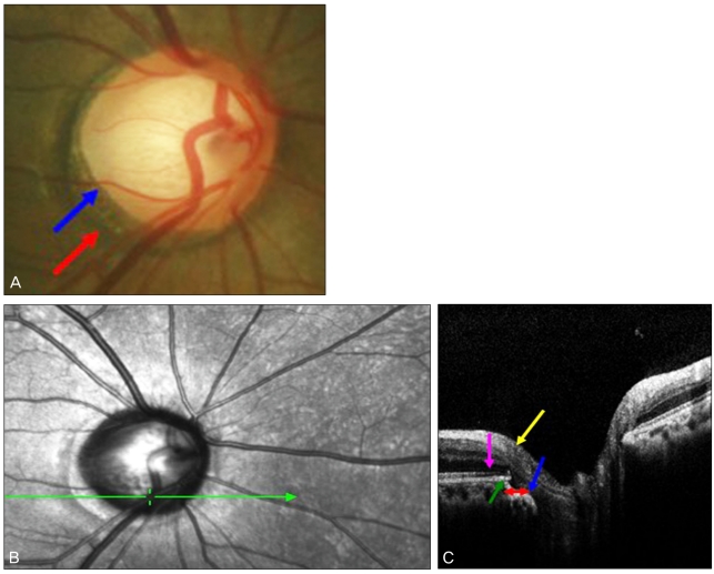 Fig. 4