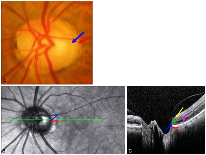 Fig. 2