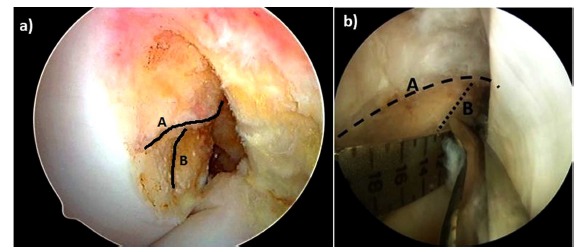 Fig. (4)