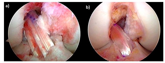 Fig. (6)