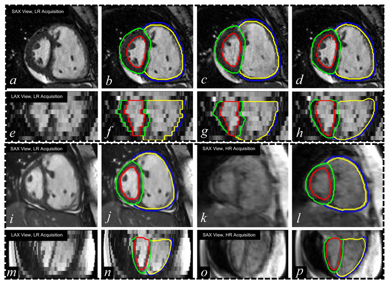 Figure 15