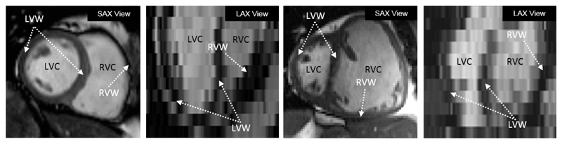 Figure 14