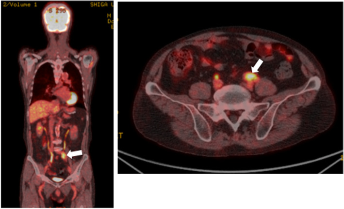 Fig. 2