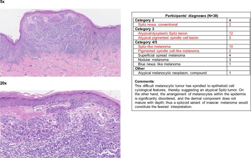 Figure 2b