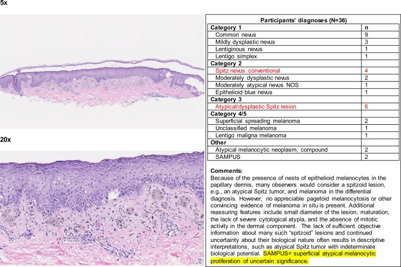 Figure 2d