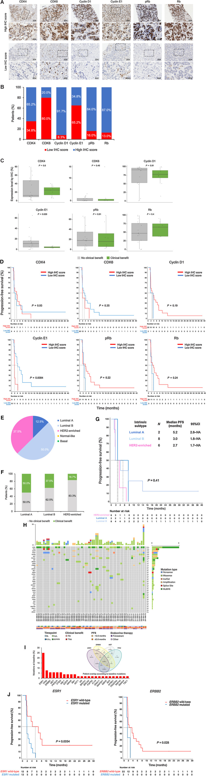 Figure 2. Representative IHC staining (A) and quantification of baseline protein biomarkers involved in the cyclin D1-CDK4/6-retinoblastoma axis (B). Correlation of baseline protein expression with clinical benefit (C) and progression-free survival (D). Intrinsic molecular subtypes by PAM50 (E) and their correlation with clinical benefit (F) and progression-free survival (G). H, Distribution and number of gene mutations by patient in circulating tumor DNA. I, Prevalence of gene mutations and Venn diagram with the 4 most frequent mutated genes observed in circulating tumor DNA at baseline. J, Correlation of baseline gene mutations with progression-free survival. Abbreviations: BL, baseline; C1D15, day 15 of the cycle 1; C4D1, day 1 of the cycle 4; CDK4, cyclin-dependent kinase 4; CDK6, cCyclin-dependent kinase 6; ctDNA, circulating tumor DNA; EOT/PD, end of treatment or progressive disease; ET, endocrine therapy; Ins/Del, insertions or deletions; NA, not achieved; PFS, progression-free survival; pRB, phosphorylated retinoblastoma; Rb, Retinoblastoma.