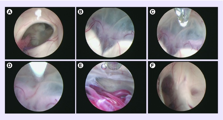 Figure 3. 