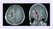 <b>Figure 6.</b>