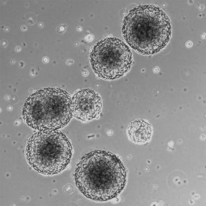 Insulin-producing neurospheres