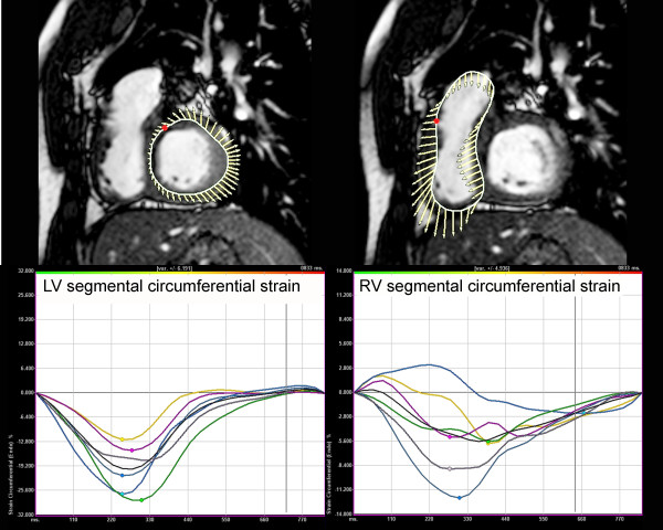 Figure 22