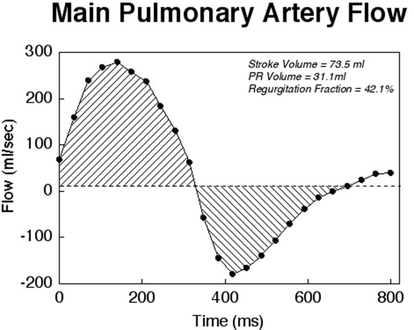 Figure 17