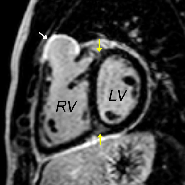 Figure 18