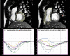 Figure 22