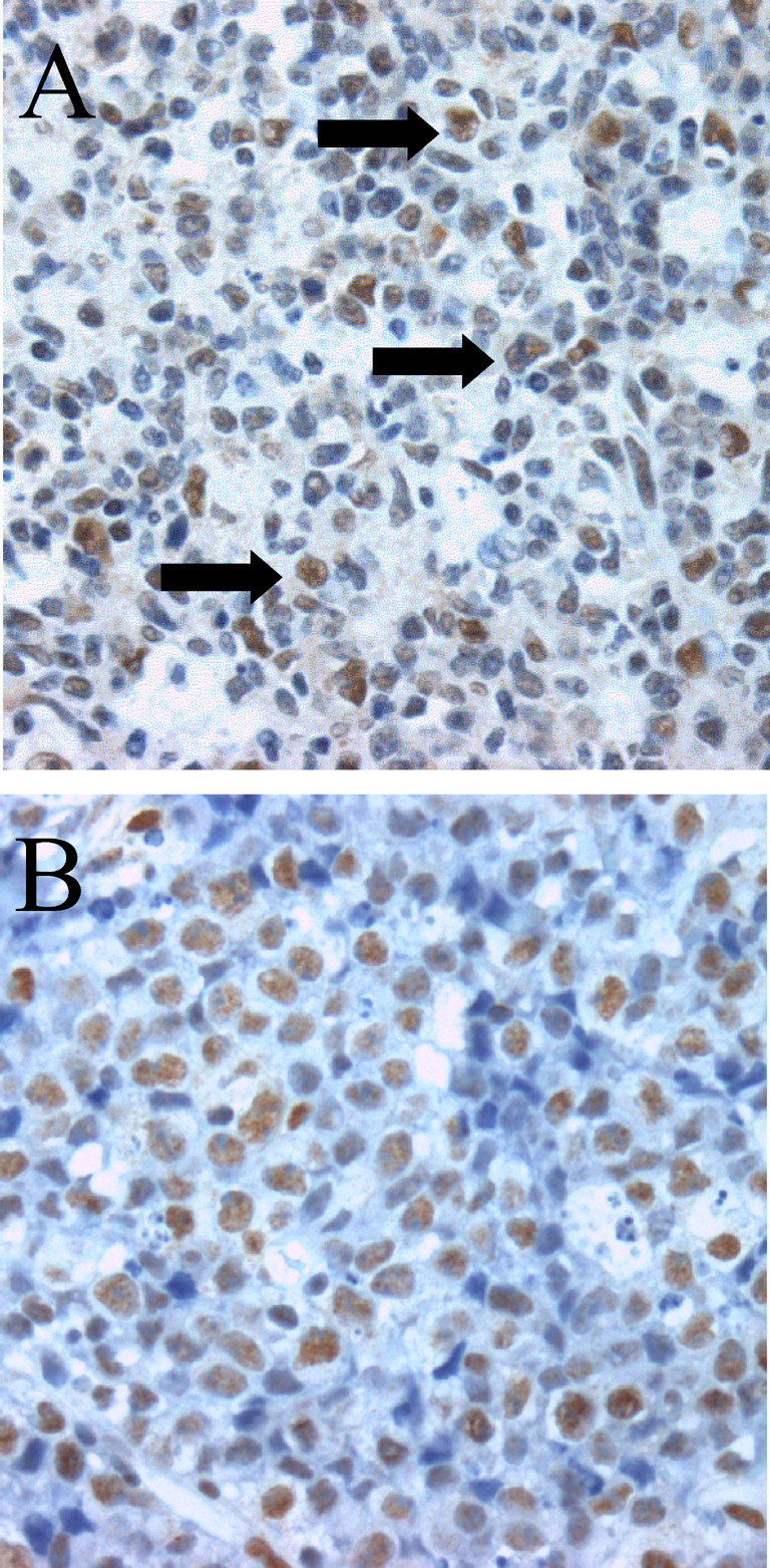 Fig. 2A, B