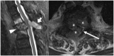 Figure 14.