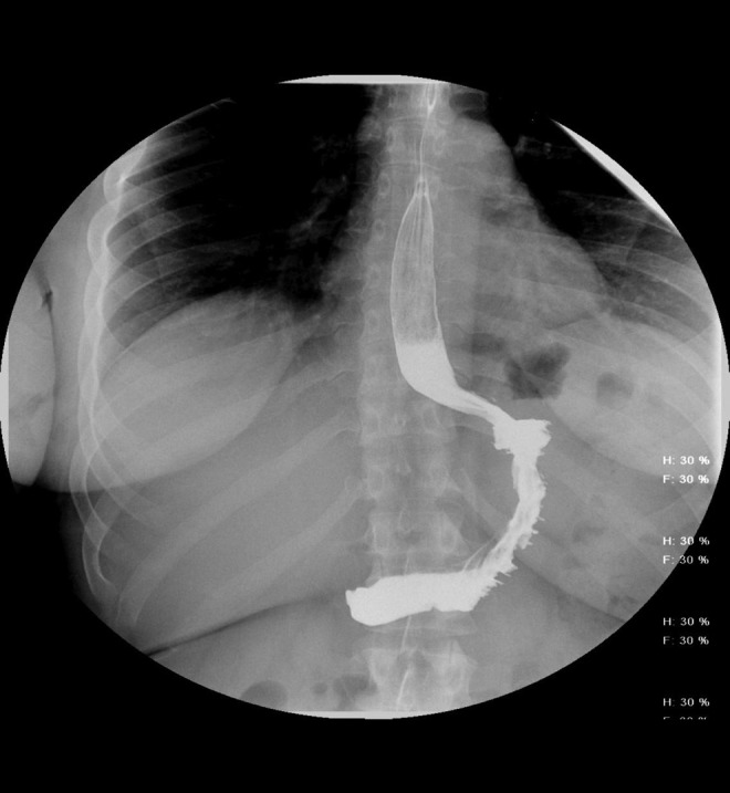 FIG. 1.