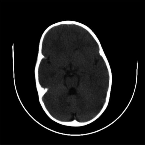 Fig. 3