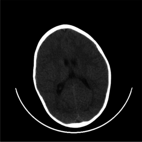 Fig. 2