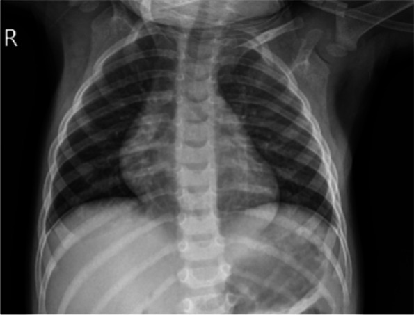 Fig. 1