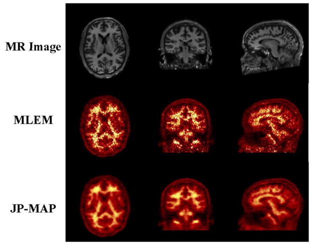 Figure 16