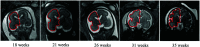 FIG 2.