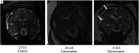 FIG 6.