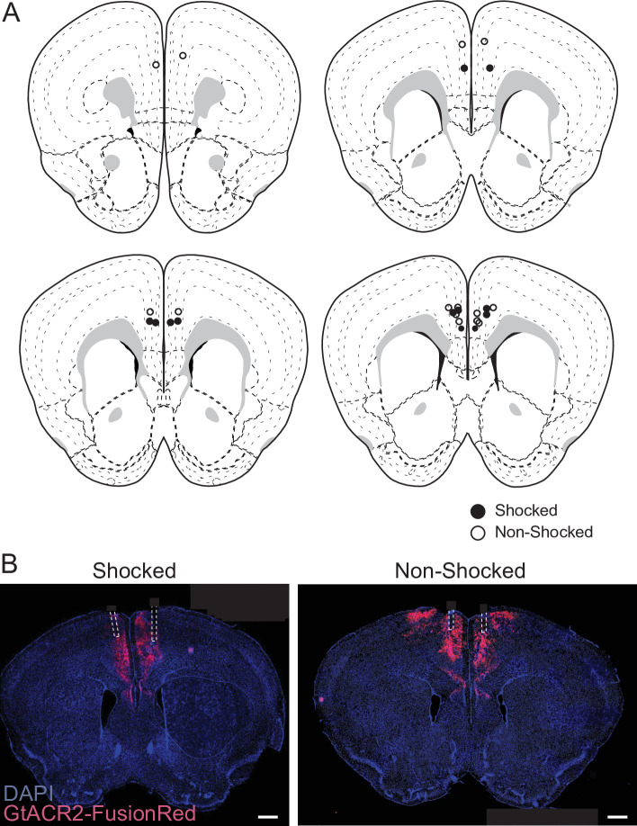 Figure 3—figure supplement 1.