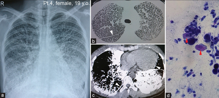 Figure 4: