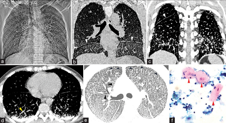 Figure 2: