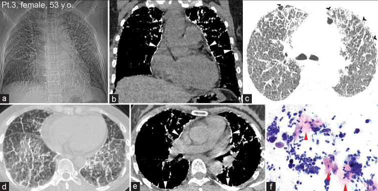 Figure 3: