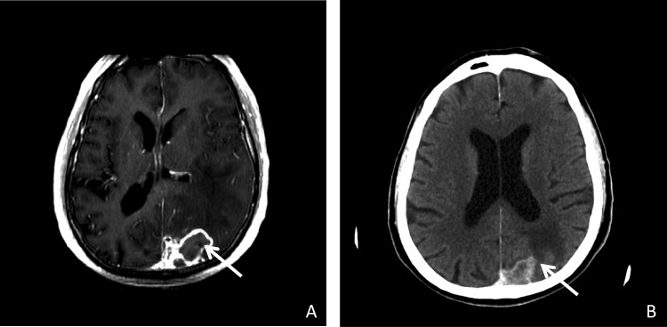 FIG 1