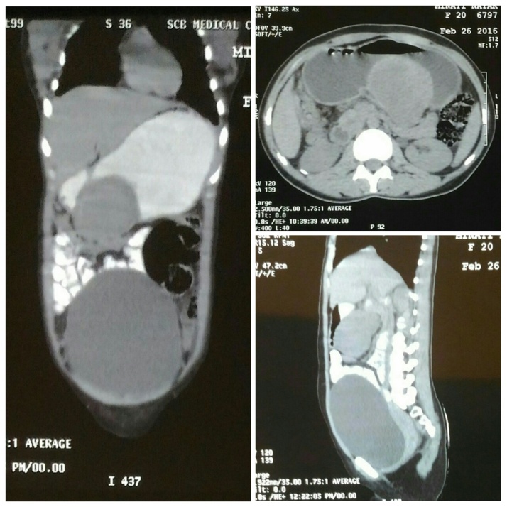 Fig. 1