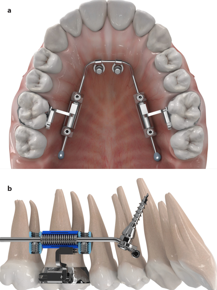 Figure 1. a, b